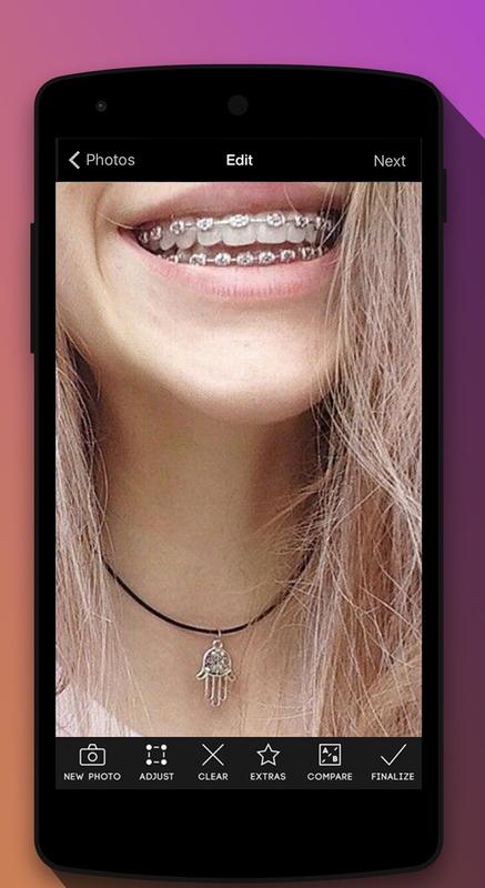 braces teeth booth camera apk download free photography app for