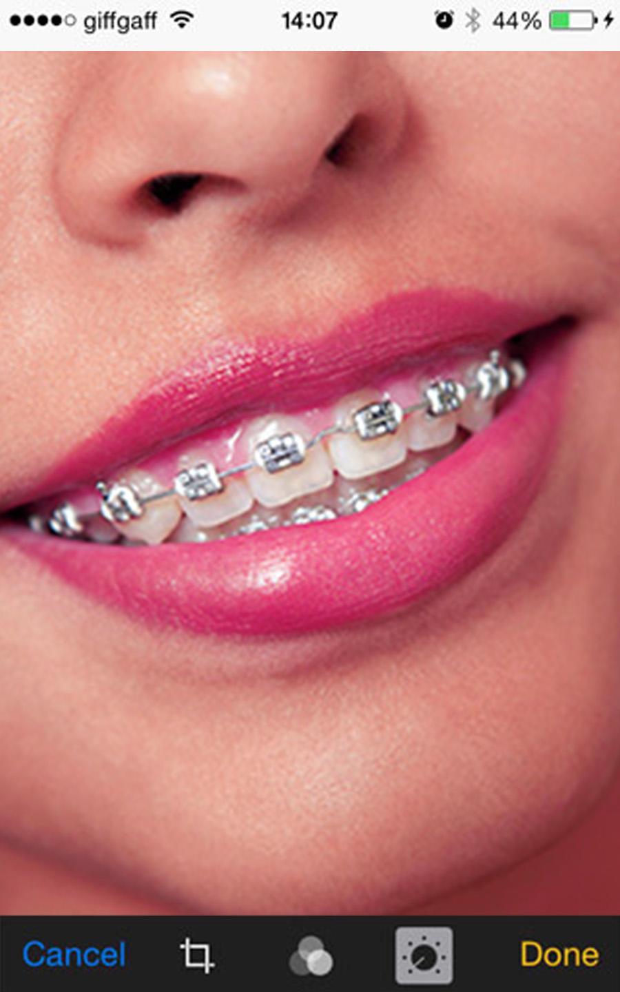 Braces-Cute Braces Camera APK pour Android Télécharger