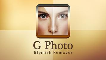 G Photo Blemish Remover screenshot 1