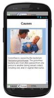 Gonorrhea Disease & Symptoms ảnh chụp màn hình 3