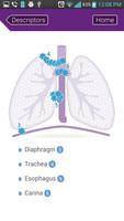 TNM Lung Staging capture d'écran 2