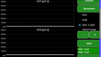 BioEMG スクリーンショット 1