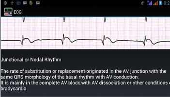 برنامه‌نما Ecg Interpretation عکس از صفحه