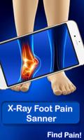 X-ray Foot Pain scanner Prank Affiche