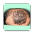 Make Your Friend Bald : Image Editor