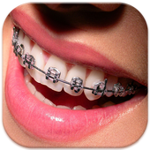 Braces Teeth Booth Pro icon