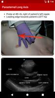 برنامه‌نما POC Ultrasound Guide عکس از صفحه