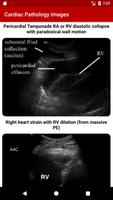 برنامه‌نما POC Ultrasound Guide عکس از صفحه