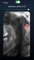 Dental Panoramic Radiology screenshot 2