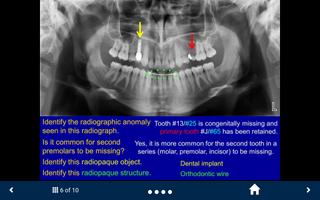 Oral Radiology Lite-SecondLook capture d'écran 1