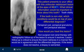 Oral Radiology Lite-SecondLook capture d'écran 2