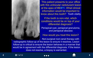 Oral Radiology Lite-SecondLook screenshot 2