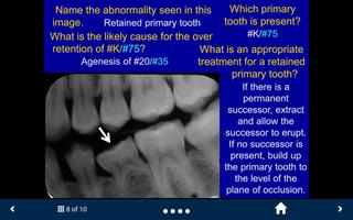 Oral Radiology Lite-SecondLook capture d'écran 3
