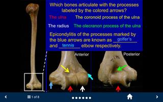 MSK Anatomy Lite - SecondLook ảnh chụp màn hình 1