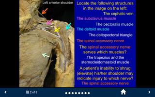 MSK Anatomy Lite - SecondLook ảnh chụp màn hình 2