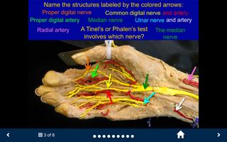 MSK Anatomy Lite - SecondLook ảnh chụp màn hình 3