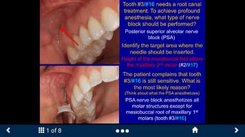Dental Anesthesia Lite - SecondLook screenshot 1