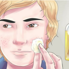Como eliminar el acné आइकन
