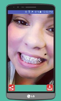 braces teeth real braces edit apk download free photography app