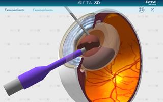 OFTA 3D 截图 1