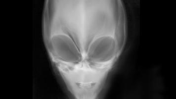 X-Ray Scanner Prank capture d'écran 1