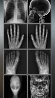 X-Ray Scanner Prank capture d'écran 2
