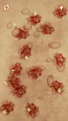 Скачать Прыщи и Zits XAPK