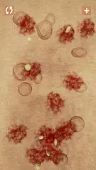 Скачать Прыщи и Zits XAPK