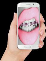 Real Braces teeth تصوير الشاشة 2