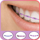 Braces Girls APK