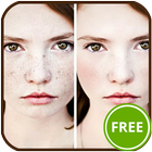 Blemish Remover icon