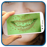 ”Teeth Bacteria Scanner Prank