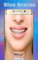 Braces Teeth постер