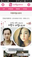 연세up성형외과(쌍수후기,눈매교정,쌍커풀수술,쌍꺼풀수술 截圖 2