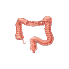 Intussusception icon