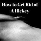 How to Get Rid Of a Hickey أيقونة