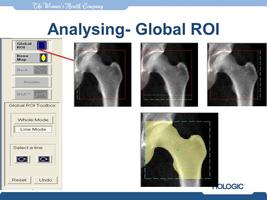 Hologic DXA capture d'écran 1