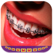 Real Braces Booth Photo Editor