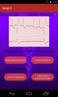 Electrocardiograma screenshot 2