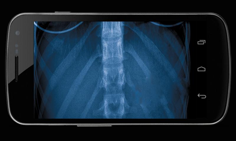 Хороший x ray Хороший x ray