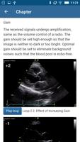 Basic - Transthoracic Echo screenshot 1