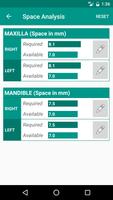 iSpaceAnalysis capture d'écran 3