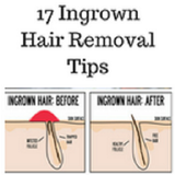 Ingrown hair removal icône