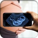 Ultrasound Scanner (Prank) APK