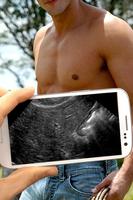 Ultrasound Scanner (Prank) gönderen