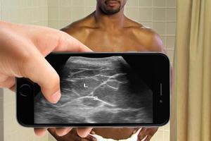 Ultrasound Scanner (Prank) Ekran Görüntüsü 1