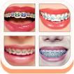 Teeth Braces Sticker Editor