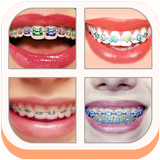 Teeth Braces Sticker Editor icône