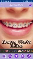 Teeth Braces Sticker Editor Affiche