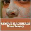 Remove Blackheads Home Remedy